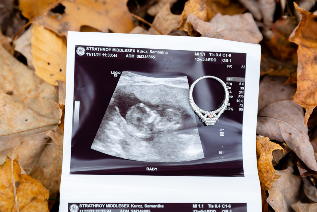 Fall engagement session with pregnancy announcement!